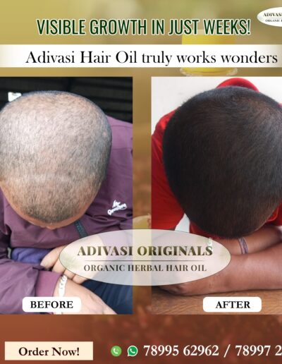 Adivasi-Originals-adivasi-oil-Before-After-2