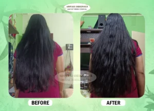 Before After Result of Our Adivasi Hair Oil 2