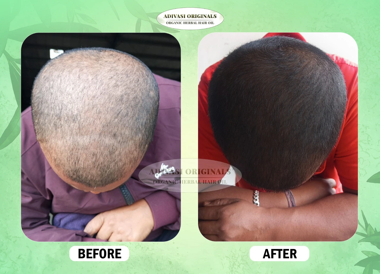 Before After Result of Our Adivasi Hair Oil 3 Before After Result of Our Adivasi Hair Oil 3