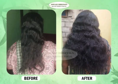Before After Result of Our Adivasi Hair Oil 6