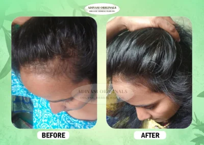 Before After Result of Our Adivasi Hair Oil 7